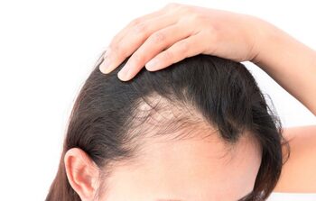 IS HAIR LOSS STRESSING YOU OUT?

